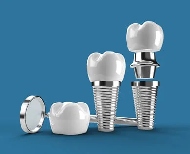 Dental implant