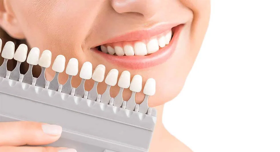What are Teeth Whitening Methods? | RivaDent