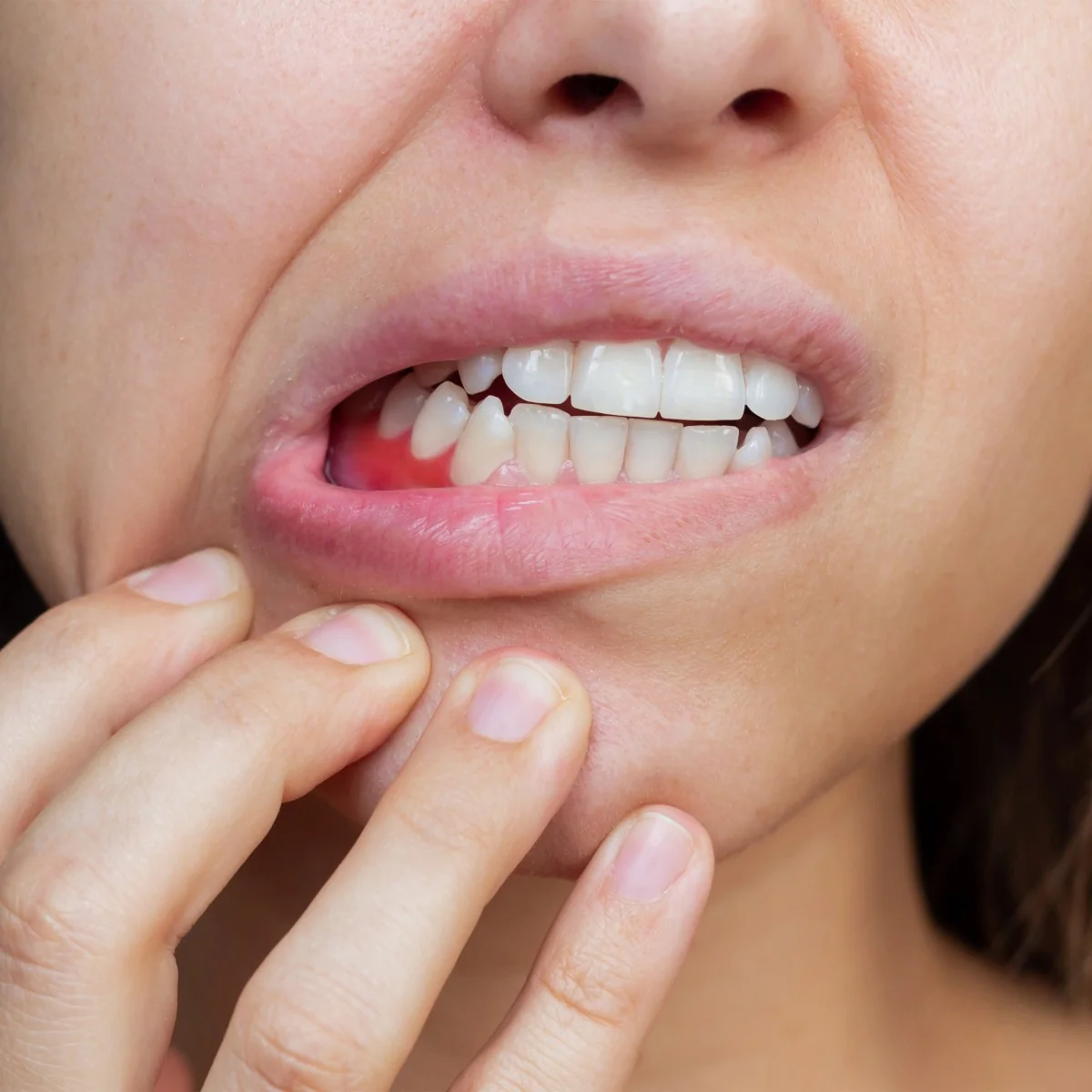 Gum Recession: Causes, Symptoms, and Treatment Methods | RivaDent
