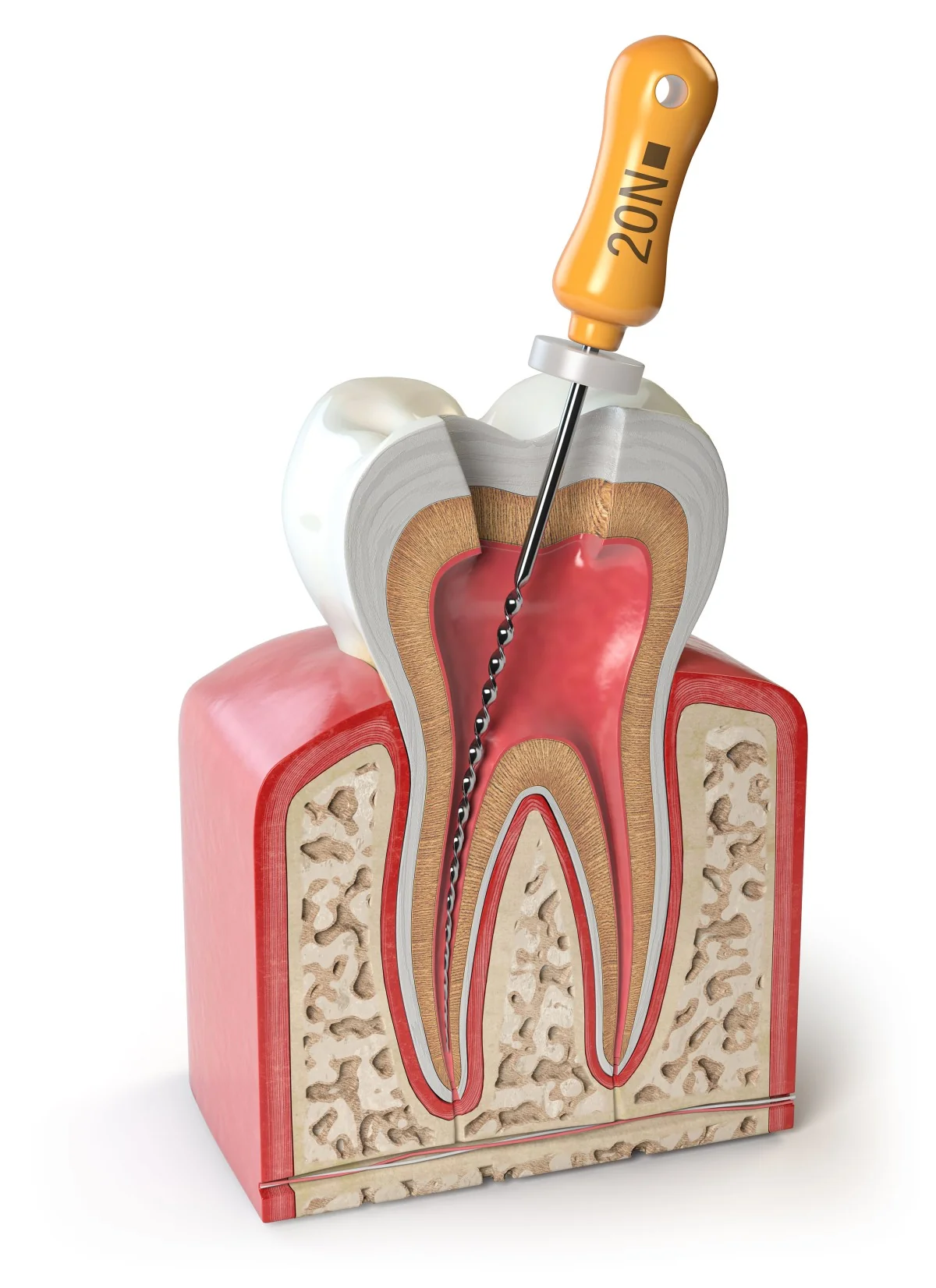 Endodontic Root Canal Treatment | RivaDent