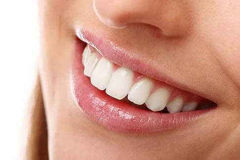 Smile Design Treatment Methods | RivaDent