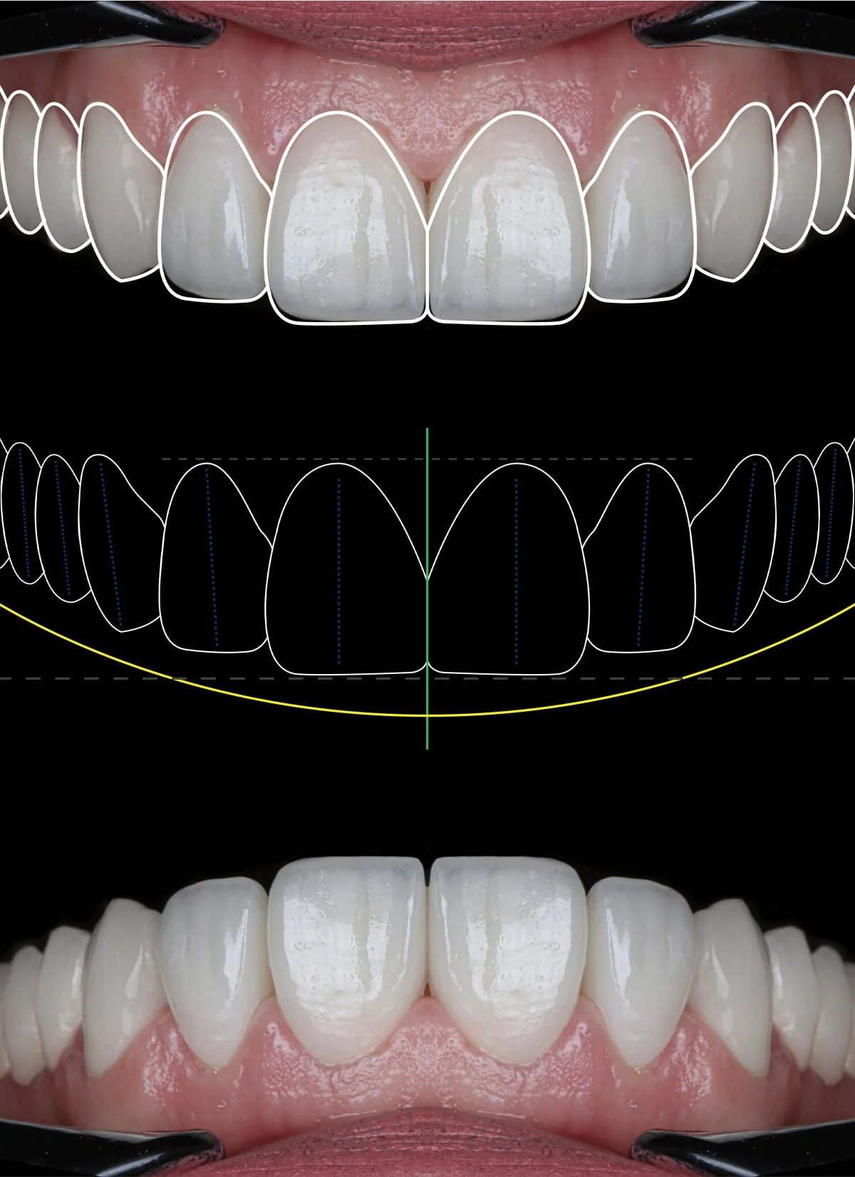 Smile Design | RivaDent