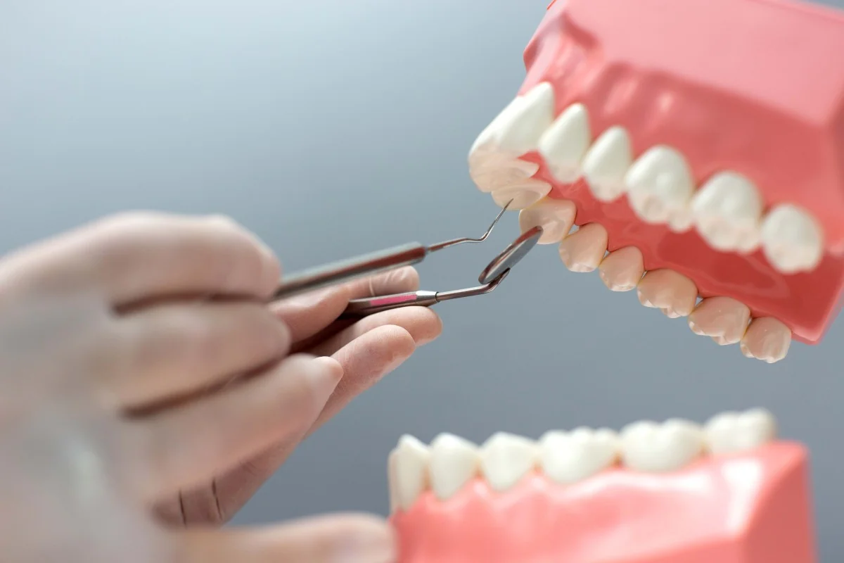 Zirconium and Metal-Backed Porcelain Veneers: Which is More Suitable for You? | RivaDent