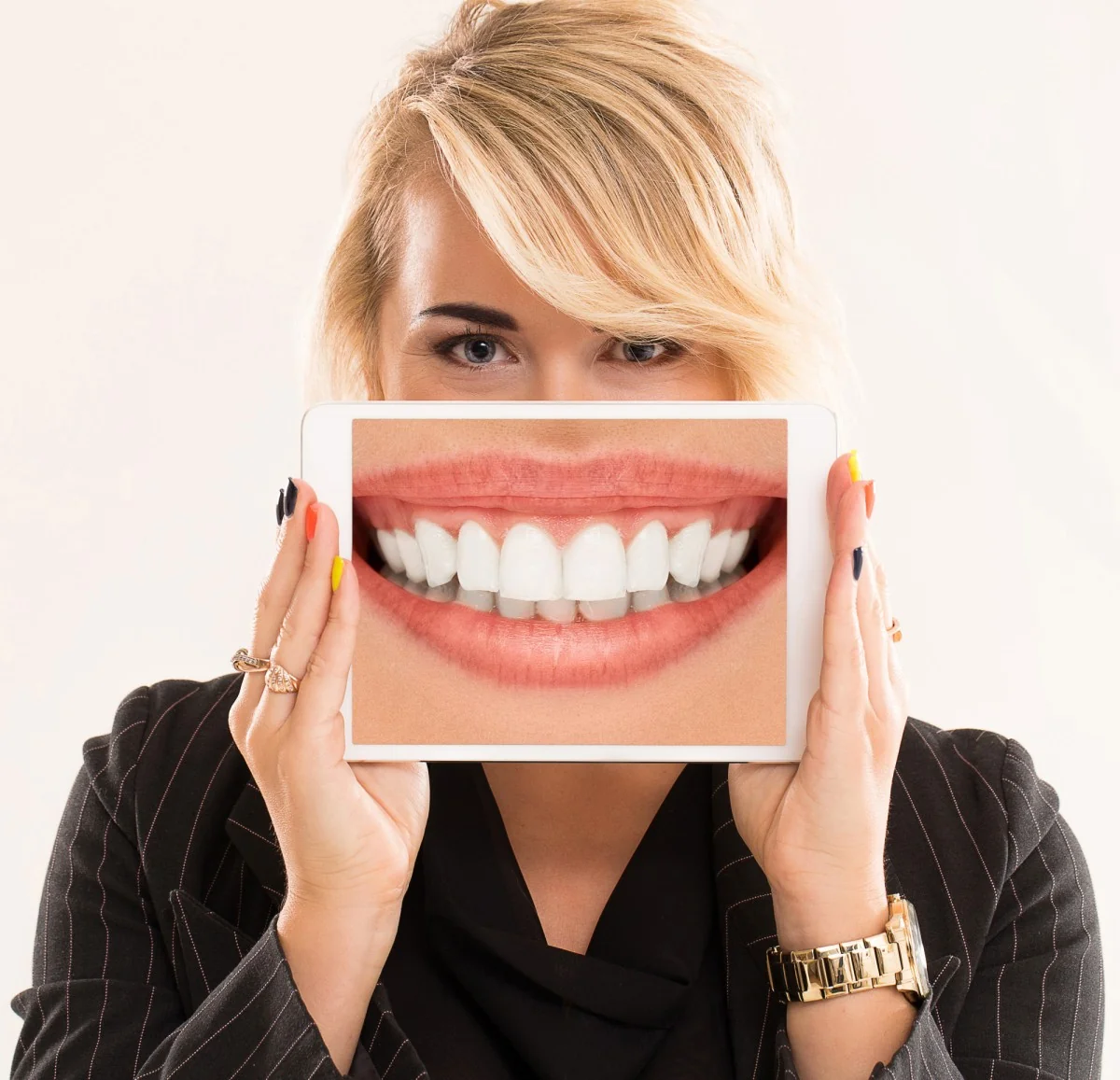 Zirconium and Metal-Backed Porcelain Veneers: Which is More Suitable for You? | RivaDent